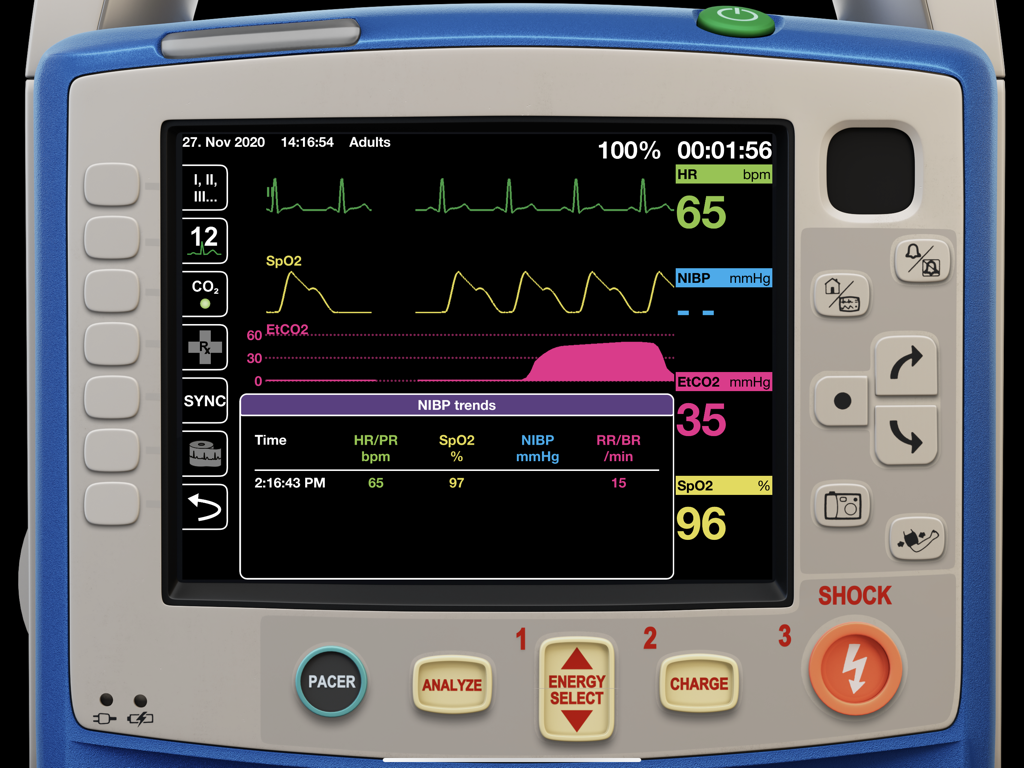 Digital simulation of a Zoll X series medical monitor showing vital signs and ECG data