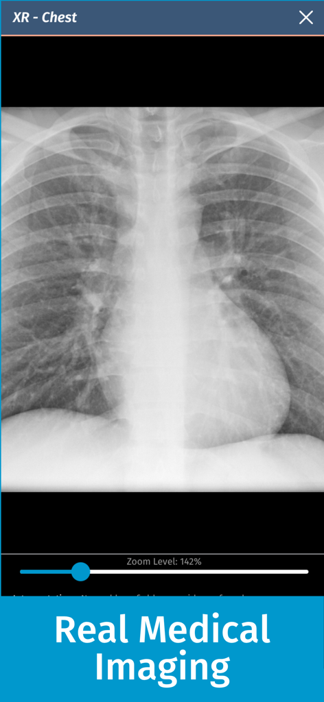 Simulazione diagnostica di radiografia del torace nell'app medica Full Code