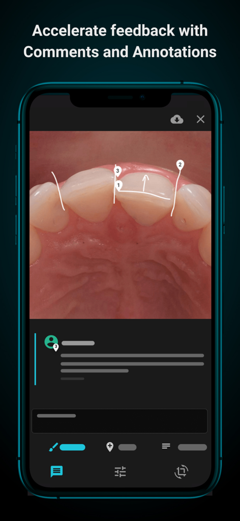 A dental case photo with white line annotations and comments for professional feedback