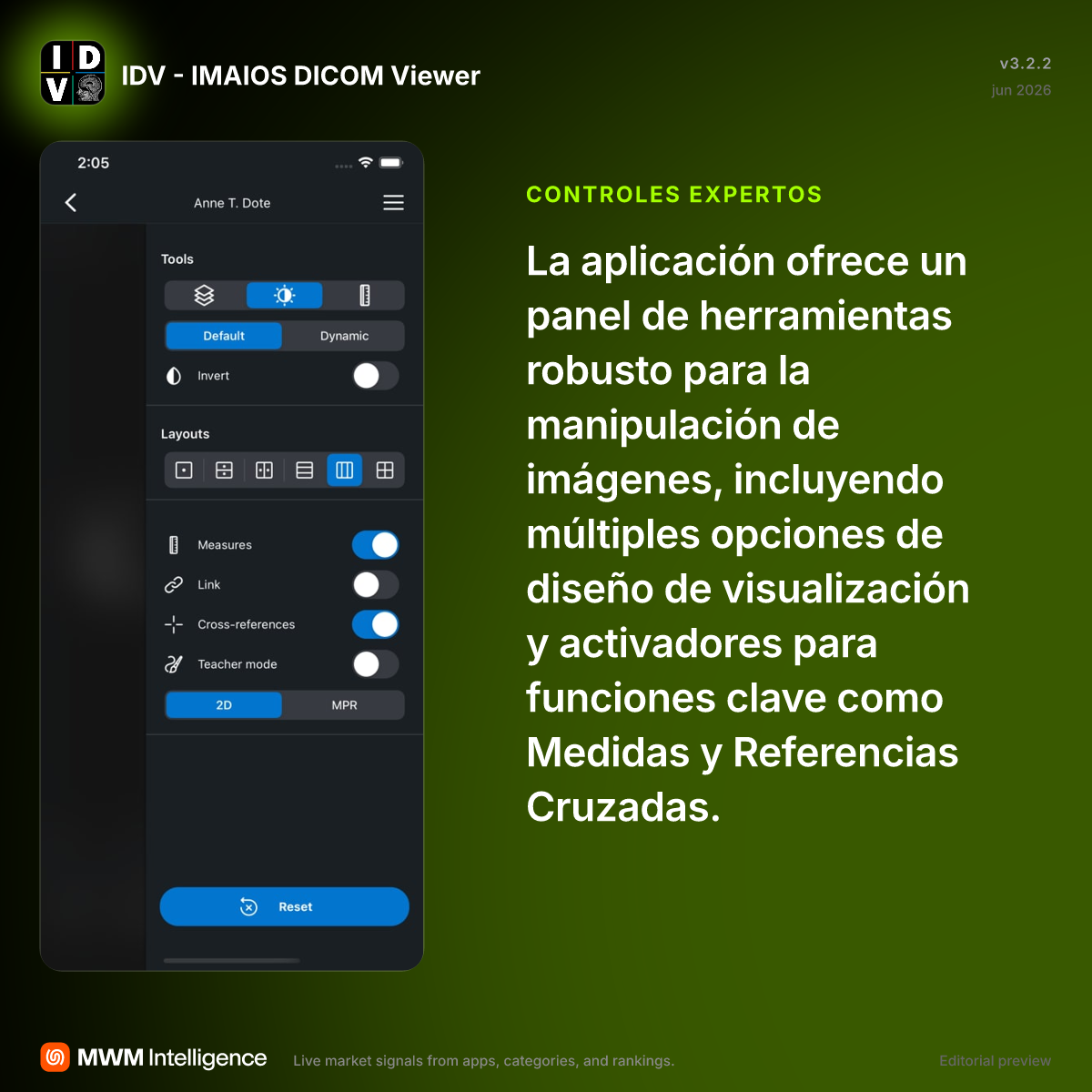 IDV - IMAIOS DICOM Viewer - App de Medicina | MWM