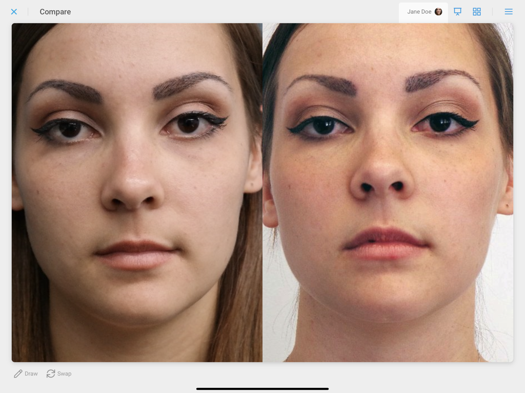 TouchMD Consult - for Staff - A side by side comparison of a patient face for medical consultation.