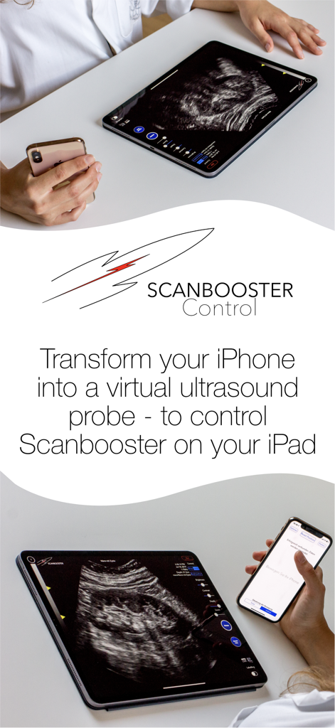 Scanbooster Control sonography - A medical professional using an iPhone as a virtual ultrasound probe to control a simulation on an iPad.