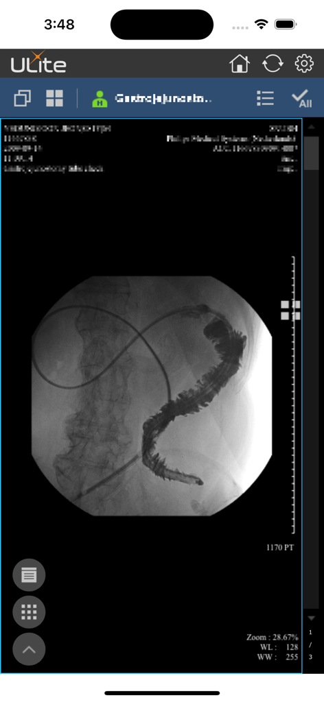 ULite - Mobile interface of the ULite app showing a radiology scan and diagnostic imaging tools