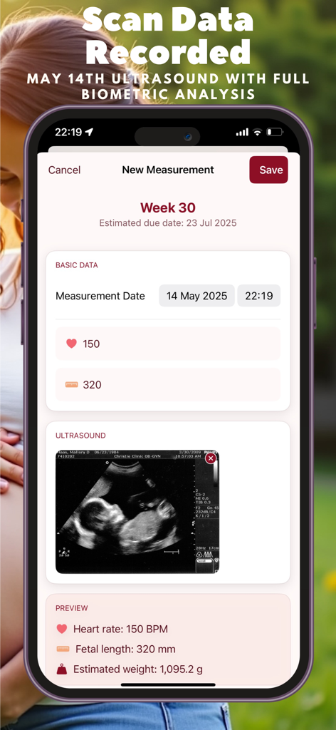 My Baby - Pregnancy Diary - Captura de pantalla de la aplicación Mi Bebé que muestra una ecografía y datos biométricos del bebé para la semana treinta