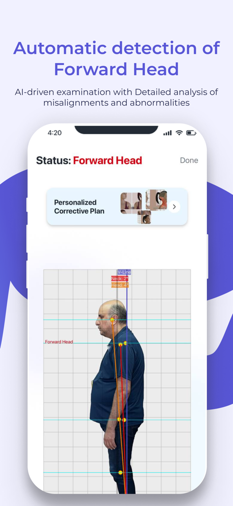 Interface do aplicativo FlexiTrace mostrando análise de IA de postura da cabeça para frente com grade de medição e opções de plano corretivo.
