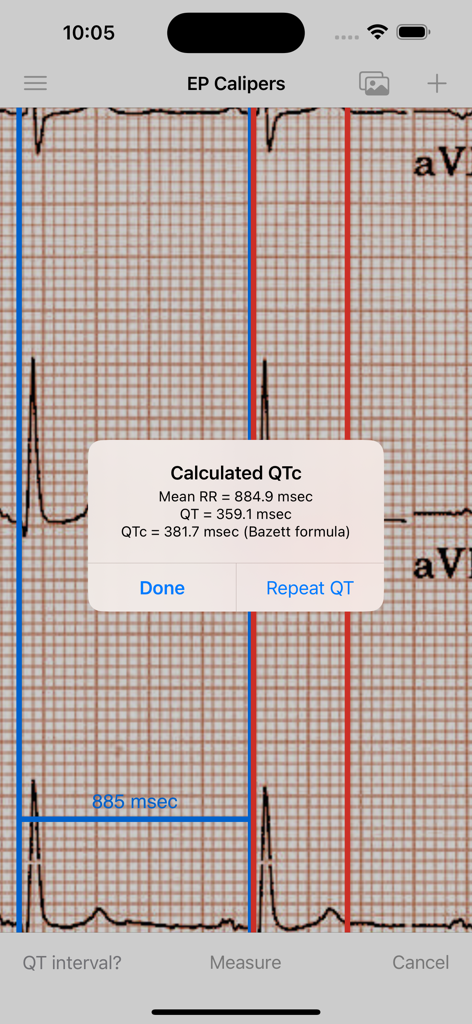 EP Calipers app displaying a calculated QTc interval on an electrocardiogram strip