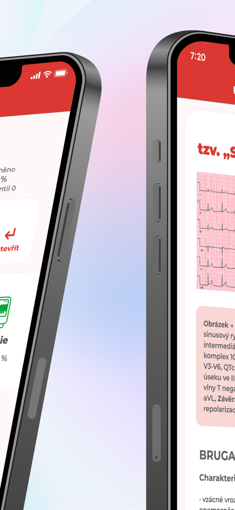 Interfaz de aplicación móvil para entrenamiento de EKG que muestra una tira de ritmo cardíaco y teoría médica en una pantalla de iPhone