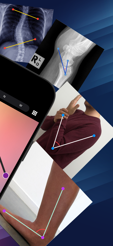 Angulus Pro - Precision Angle - Exemplos de medições de ângulos clínicos em raios-X médicos e articulações humanas para avaliação ortopédica e fisioterapêutica.