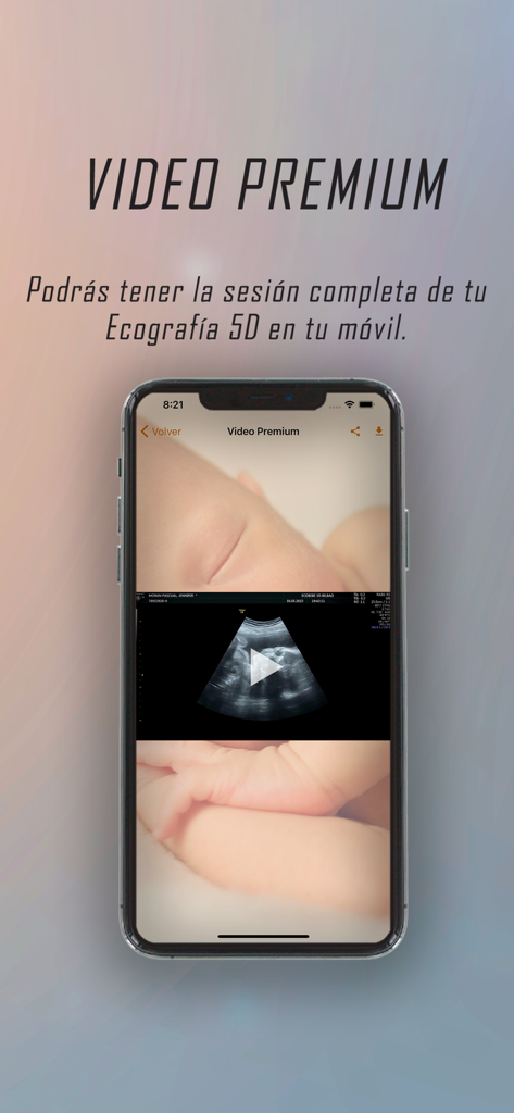 App Ecobebé - Pantalla de smartphone mostrando una sesión de vídeo de ultrasonido 5D premium de un bebé en la aplicación Ecobebe
