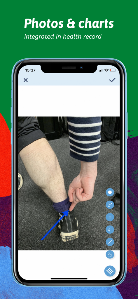 발목 근처에 파란색 화살표로 주석이 달린 환자 다리 사진과 함께 Medicapp Pro 앱 인터페이스를 보여주는 스마트폰 화면.