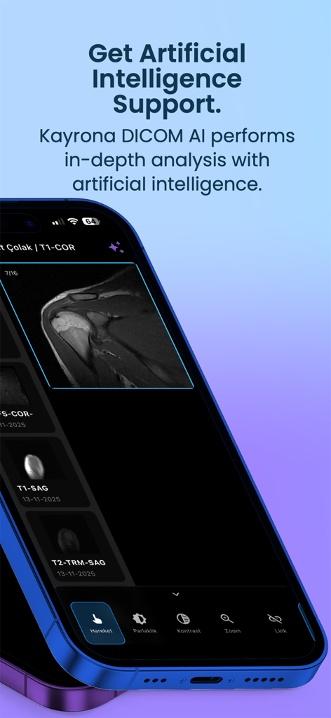 Kayrona DICOM AI Viewer - Smartphone screen of Kayrona app showing a shoulder MRI scan with a headline about artificial intelligence support and in-depth analysis.