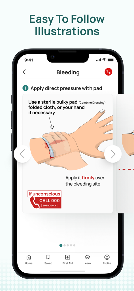 iFirstAid - iFirstAid app screen showing illustrated step by step instructions for bleeding emergency