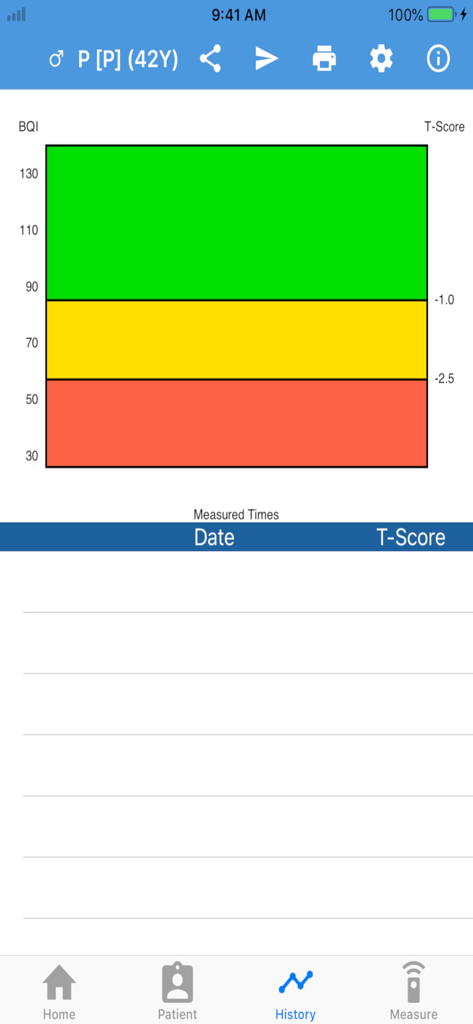 BeeTLe QUS - 색상으로 구분된 T-점수 뼈 밀도 차트와 측정 추적 테이블이 특징인 BeeTLe QUS 앱의 기록 화면.