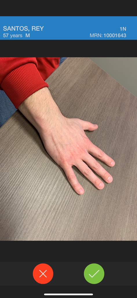 Cerner Camera Capture - Clinical photo of a patient hand being reviewed in the Cerner Camera Capture app interface