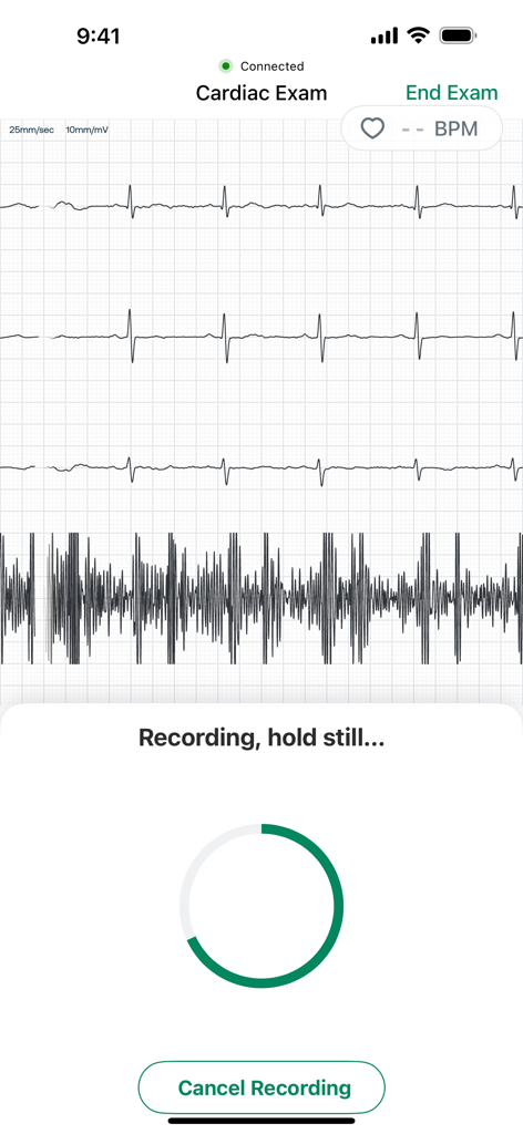 SENSORA™ by Eko Health - Interface do aplicativo SENSORA mostrando uma gravação de exame cardíaco com ECG ao vivo e formas de onda de som cardíaco