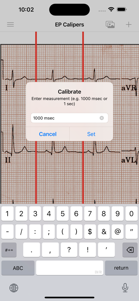 The EP Calipers app showing a calibration popup window over an electrocardiogram image to set measurement intervals.