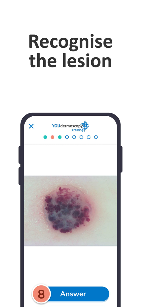 YOUdermoscopy - Interfaz de la aplicación YOUdermoscopy para entrenamiento de reconocimiento de lesiones cutáneas