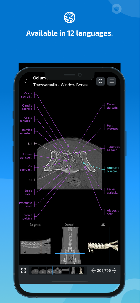 IMAIOS vet-Anatomy - Interface of the IMAIOS vet-Anatomy app displaying a labeled CT scan of animal anatomy with multiple viewing planes and anatomical terms