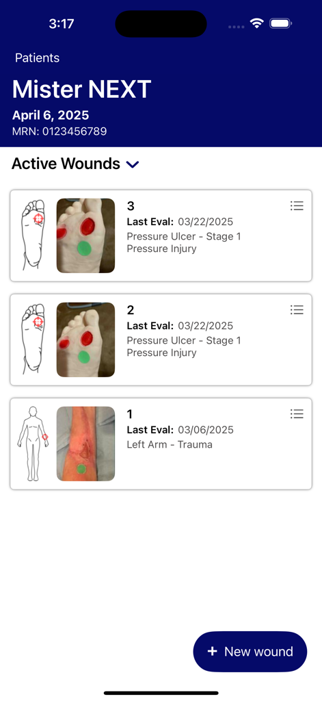 Patient profile in the Tissue Analytics app displaying a list of active wounds with evaluation dates and injury descriptions