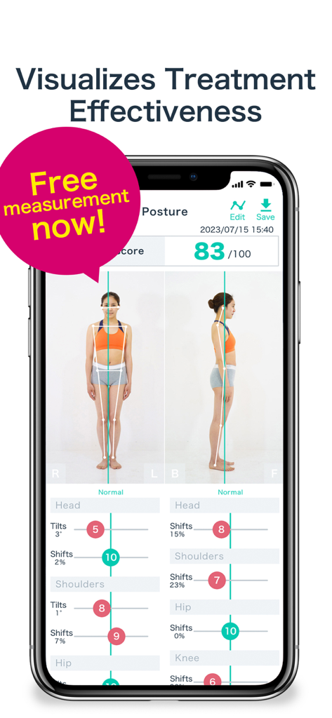 AI posture/BODY Alignment - Tela do aplicativo de análise de postura por IA mostrando pontuação de alinhamento corporal e eficácia visual do tratamento para profissionais de fitness.