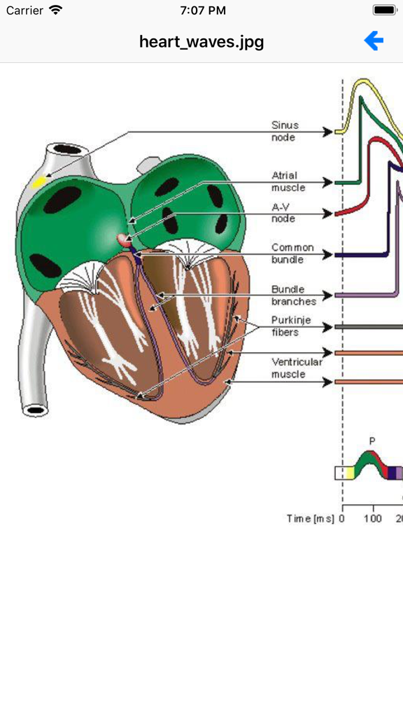 EKG Academy | Master EKG & ECG Interpretation