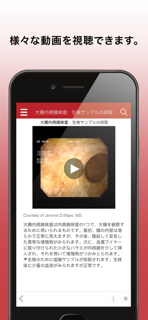 A smartphone interface showing the MSD Manual app with a medical video and descriptive text in Japanese