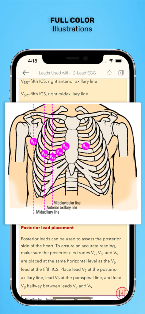 ECG Interpretation: Pkt Guide - Full color anatomical illustration of ECG chest lead placement on a human torso