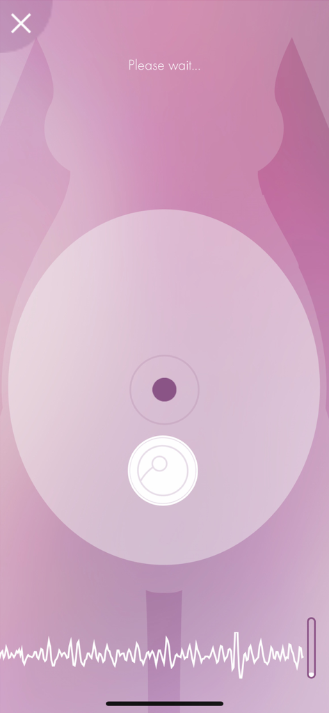 HeraBEAT - HeraBEAT app interface displaying a fetal heart rate waveform during a scan.