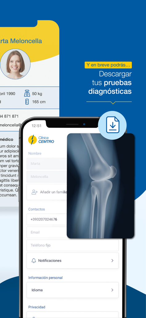 Interfaz de la aplicación CEMTRO que muestra un perfil de paciente y una radiografía de rodilla ortopédica