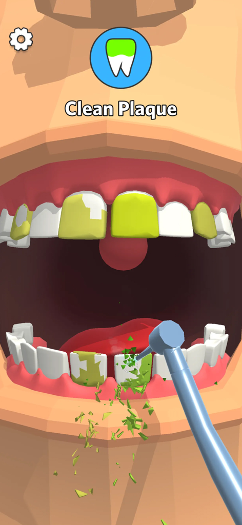 Dentist Bling - Uno strumento dentale che rimuove la placca verde dai denti nel gioco mobile Dentist Bling