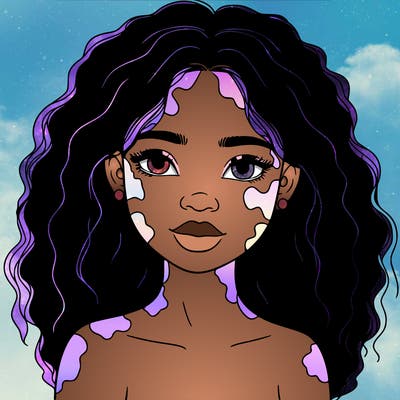 beautiful black girl with vitiligo