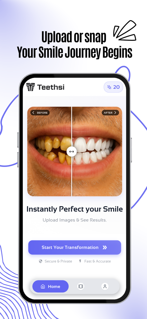 Teethsi app screen showing a side by side comparison of a smile before and after AI veneers.