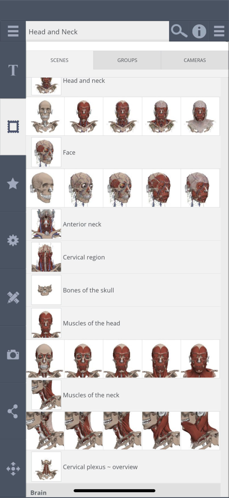 Primal's 3D Head & Neck - A gallery of 3D anatomical scenes showing various layers of the head and neck structures