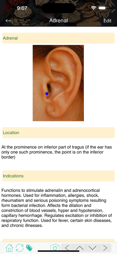 TCM Clinic Aid - TCM Clinic Aid app screen showing the Adrenal auricular acupuncture point location and clinical indications