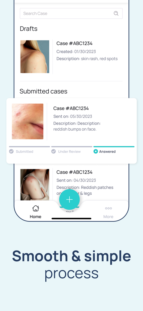 Interfaz de la aplicación móvil que muestra el estado de los casos de preocupaciones de la piel enviados para revisión por dermatólogos profesionales