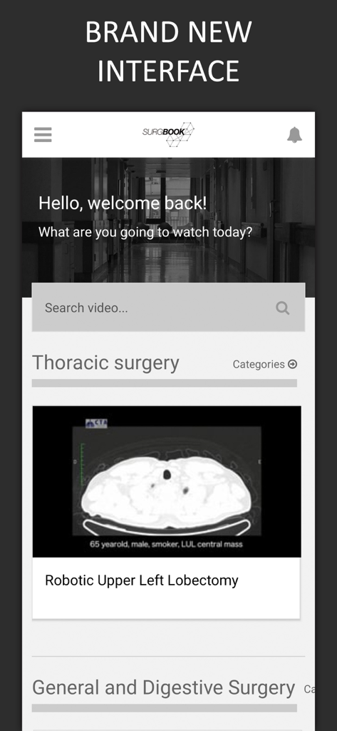 The SurgBook app dashboard showing a surgical video for Robotic Upper Left Lobectomy in the Thoracic surgery category.