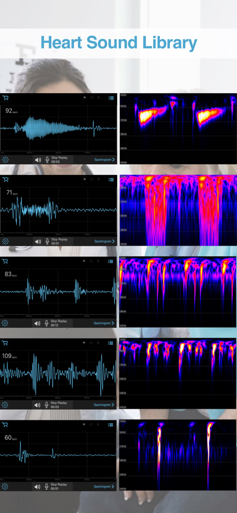 E-Stethoscope & Auscultation - A library of heart sound recordings featuring visual waveforms and spectrograms for medical analysis