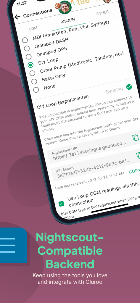 Gluroo Diabetes Logger - Oberfläche der Gluroo App, die das Nightscout-kompatible Backend und die DIY-Loop-Integrationseinstellungen für Insulinpumpen zeigt.