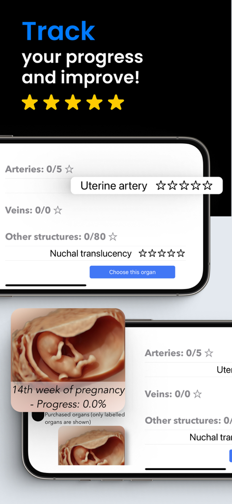 Scanbooster app dashboard showing progress tracking for a 14th week pregnancy ultrasound simulation.