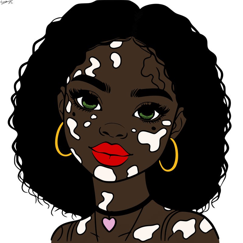 bleautiful black girl with vitiligo