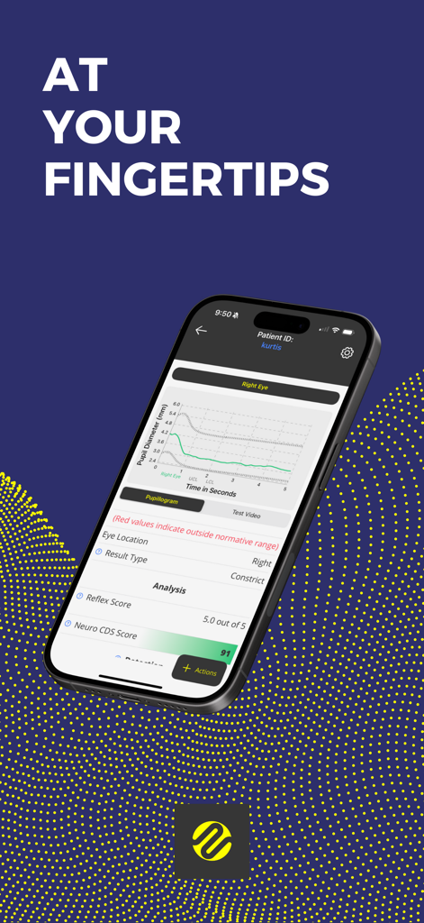 iPhone screen displaying a pupillogram graph and neurological analysis scores from the Reflex app