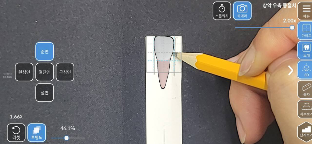 AR-D Morphology - Augmented reality overlay for dental tooth carving practice in the AR-D Morphology app