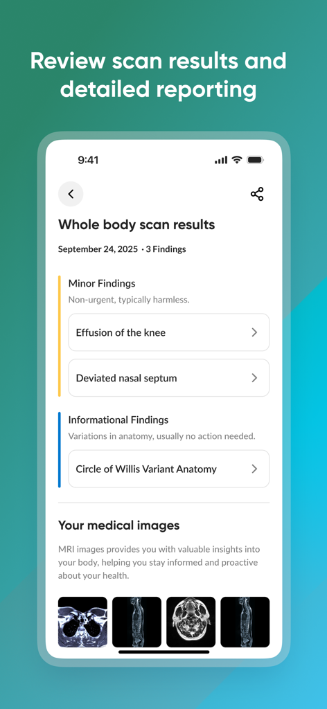 Prenuvo mobile app displaying whole body MRI scan results and detailed medical findings