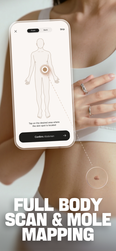 DermaScan - AI dermatologist - Interfaz de la aplicación DermaScan mostrando mapeo de lunares de cuerpo completo y función de análisis de piel