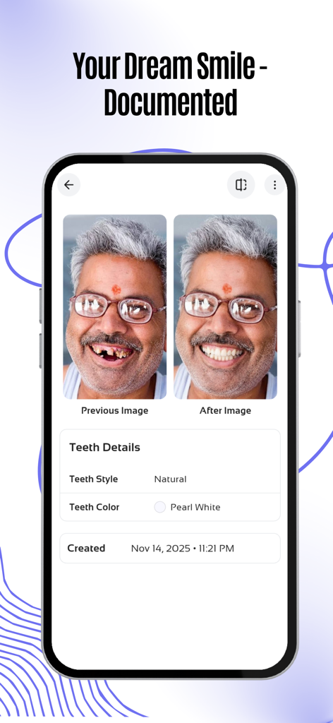 A before and after side by side comparison of a man's smile showing the results of a virtual veneer simulation in the Teethsi app