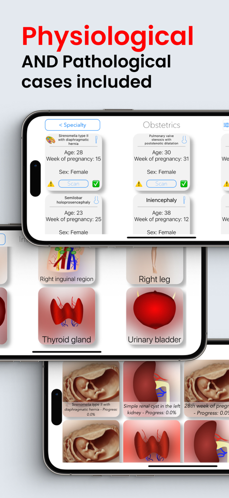 Scanbooster app interface showing various physiological and pathological ultrasound cases for medical training