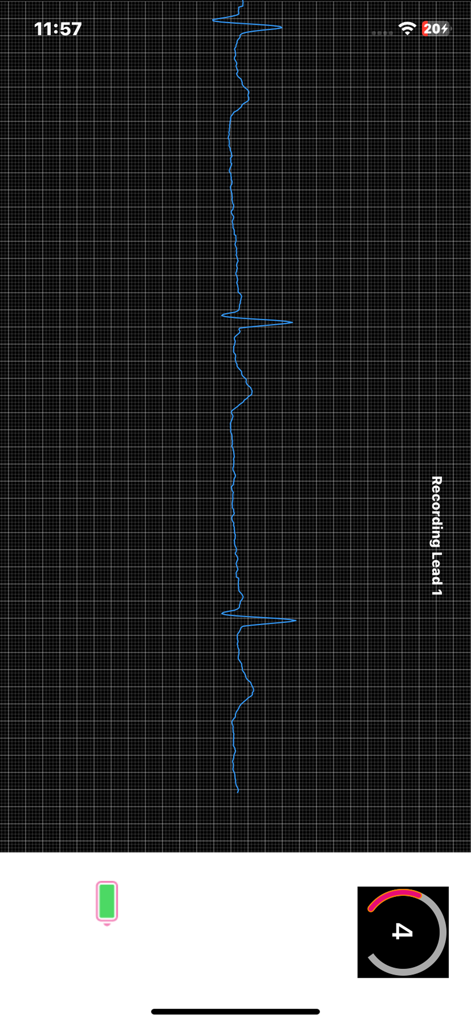 Sanket Life-ECG,Stress,Fitness - Real time ECG heart rate waveform recording on a mobile screen grid