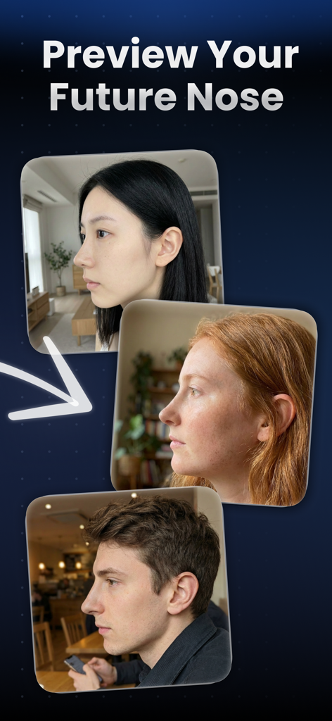 Trois photos de profil de profil montrant les résultats de simulation de rhinoplastie et de remodelage de nez par IA de l'application Nosefix.