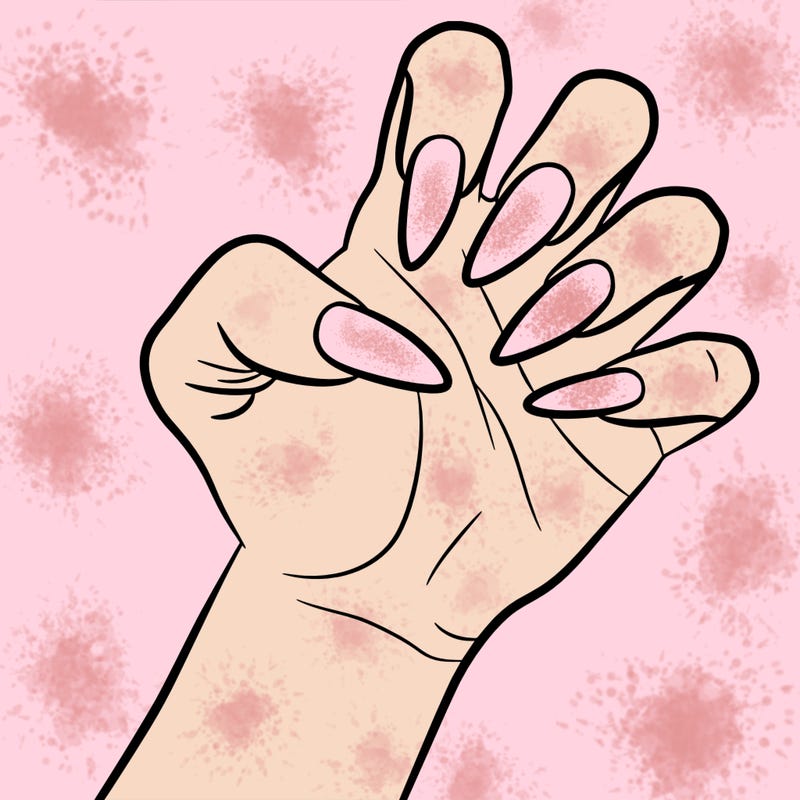After