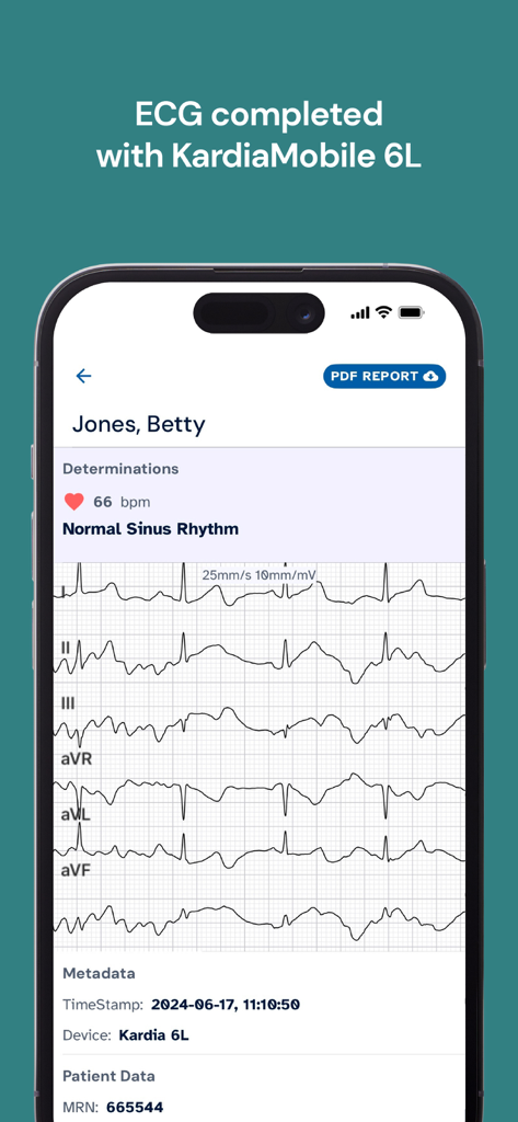 KardiaStation Professional - Interfaz de la aplicación KardiaStation Professional que muestra un informe de ECG de seis derivaciones para un paciente médico